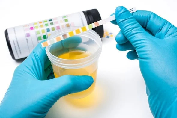 URINE ANALYSIS